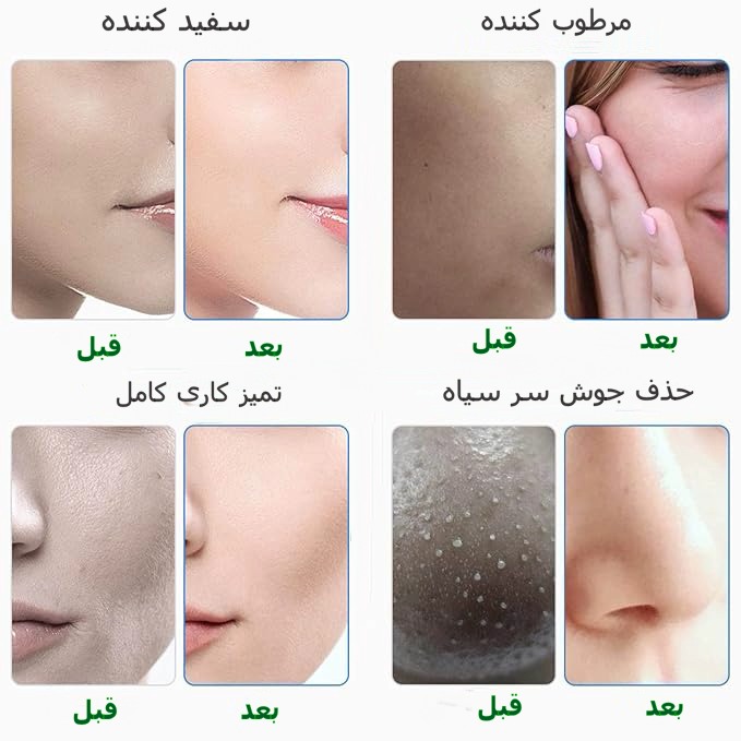 هیدروفشیال