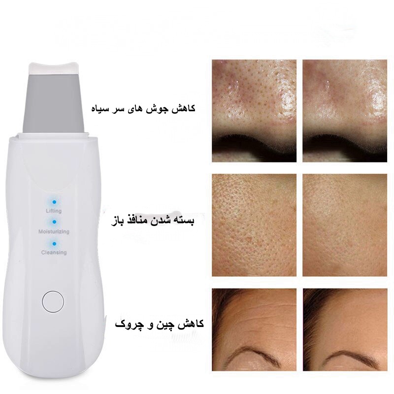 درما اف التراسونیک شاول لمسی Shovel