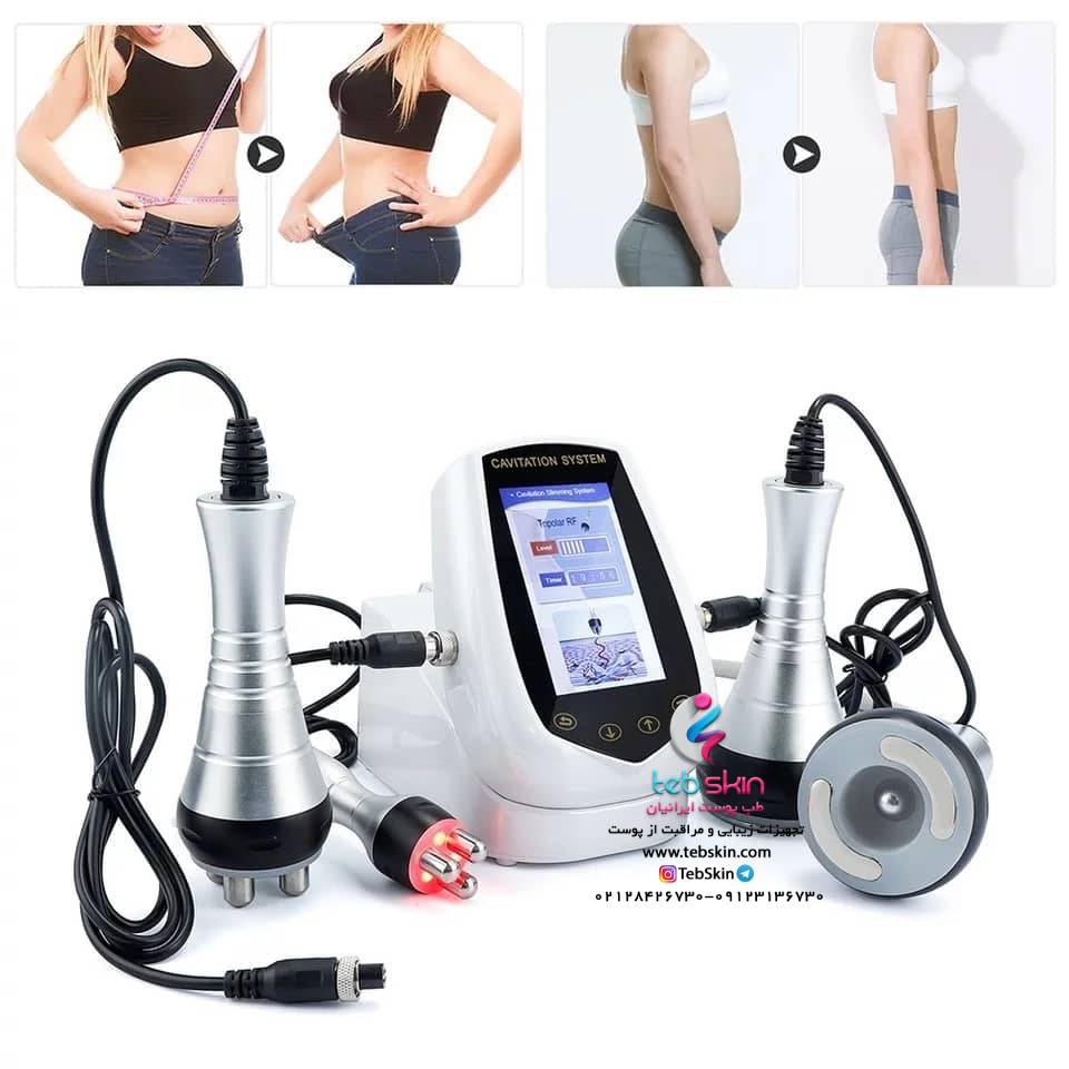 دستگاه لاغری اراف کویتیشن RF Cavitation