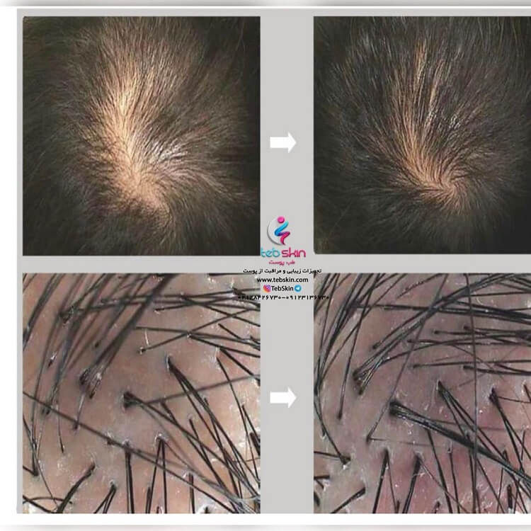 کوکتل درماهیل Dermaheal HL - تصویر 3