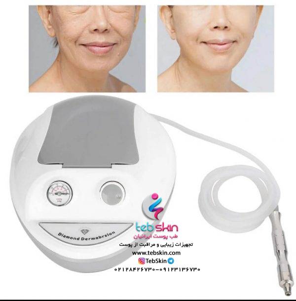 دستگاه میکرودرم الماسی - تصویر 3
